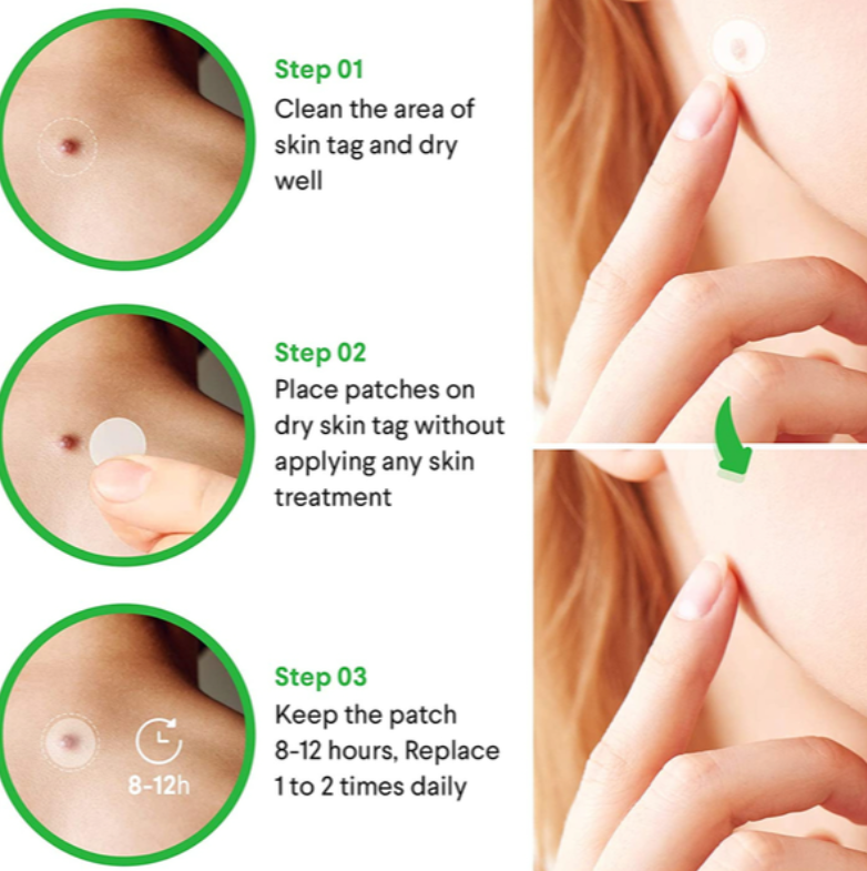 Skin Tag Remover Patch (36 Pack)