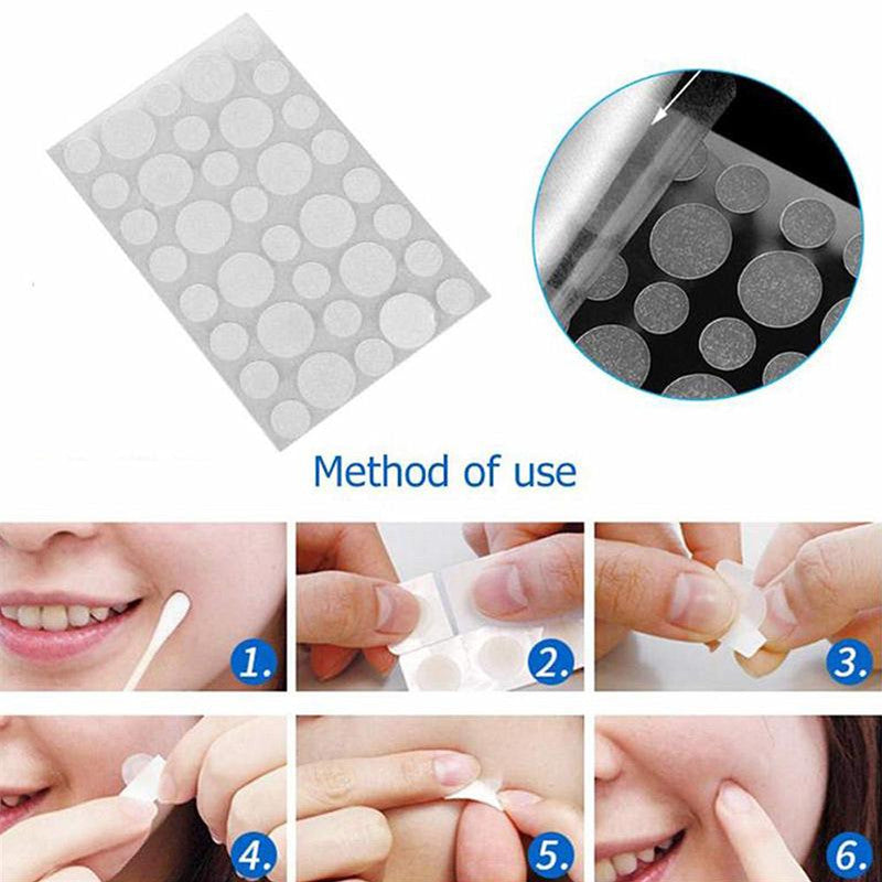 Hydrocolloid Skin Tag Remover Patch