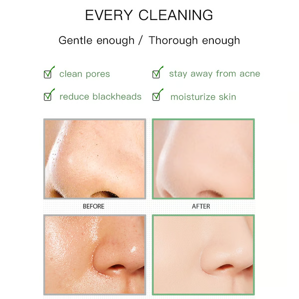 Skin Purifying Blackhead Removing Green Tea Mask