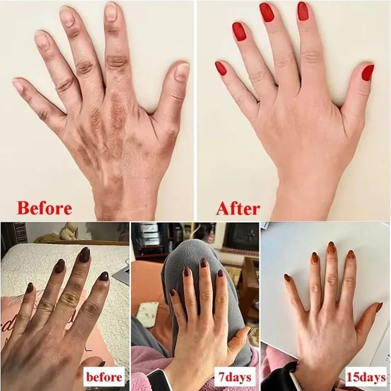 Anti-Wrinkle Hand Cream with Coconut Oil – Moisturizing Skin Care Serum