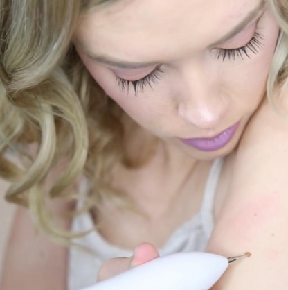 Revolutionary Skin Care Plasma Pen - USB Rechargeable Skin Tag & Mole Remover with 2200 mAh Long-Lasting Battery