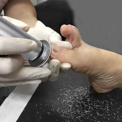 SoleSmooth Professional Electric Callus Remover – Perfect Gift for Silky Smooth Feet