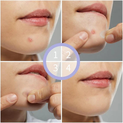 Wild+ Invisible Acne Patch